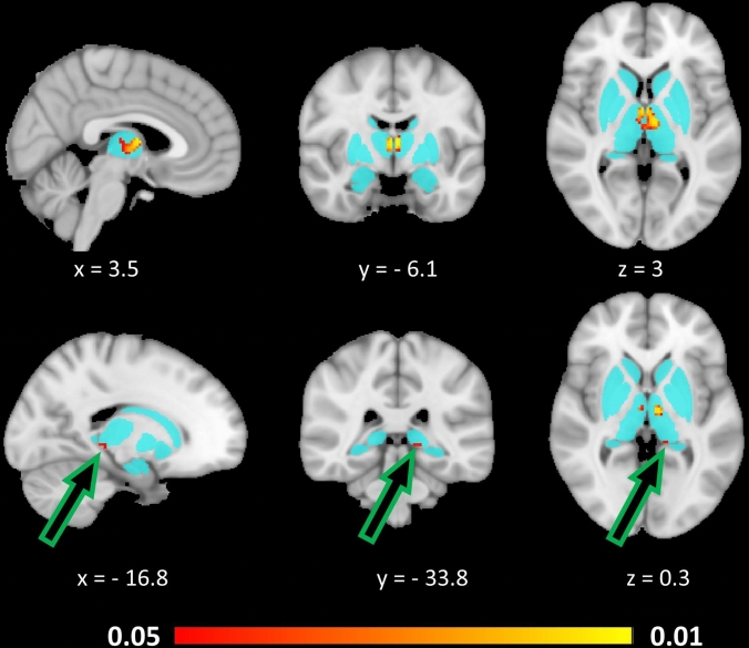 Fig. 3