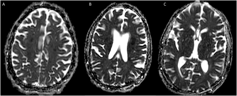 Fig. 2