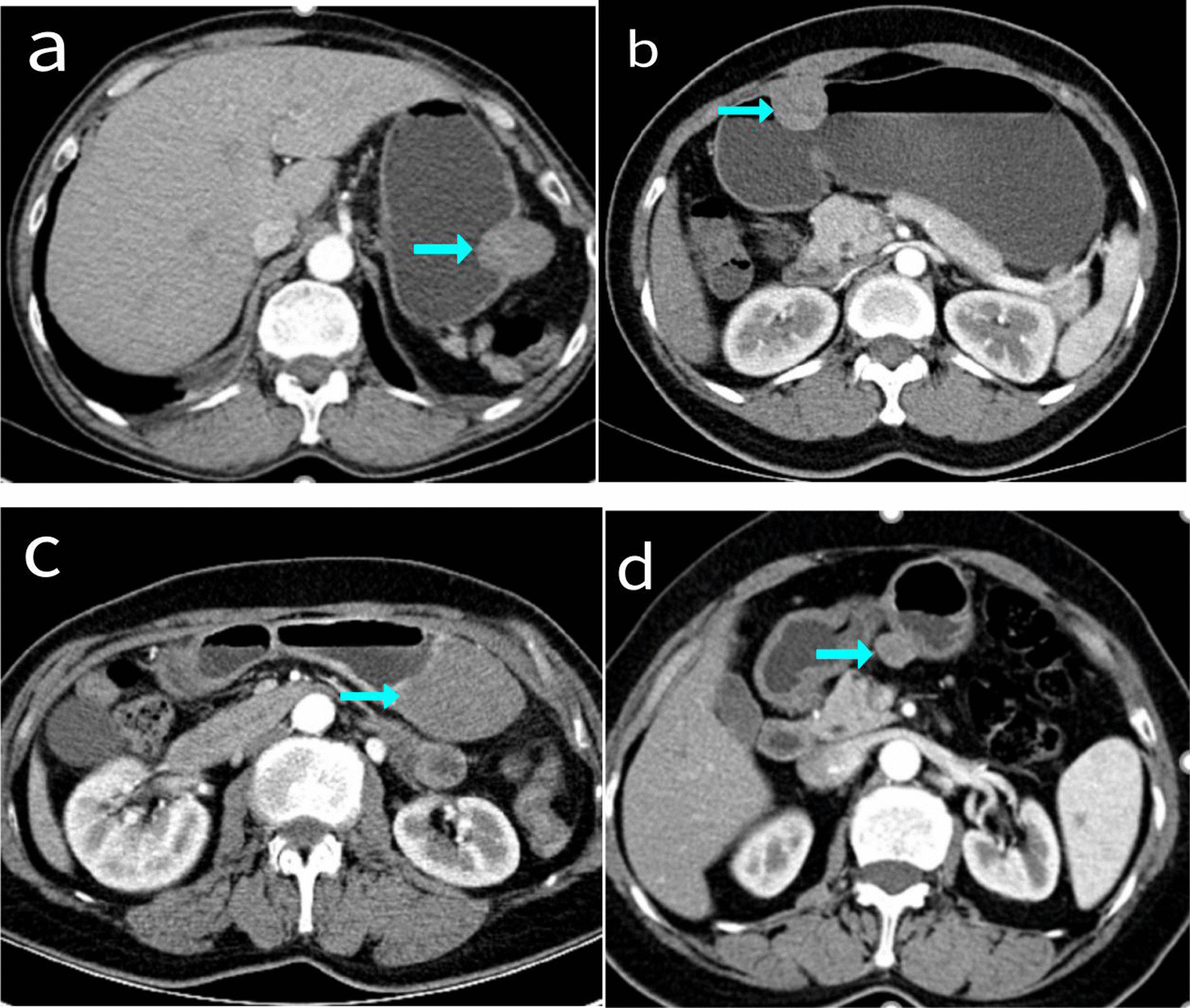 Fig. 2