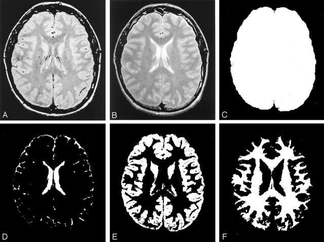 Fig 1.