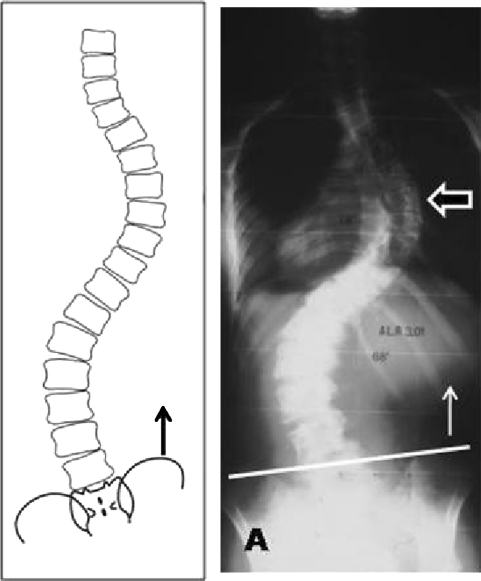 Fig. 1