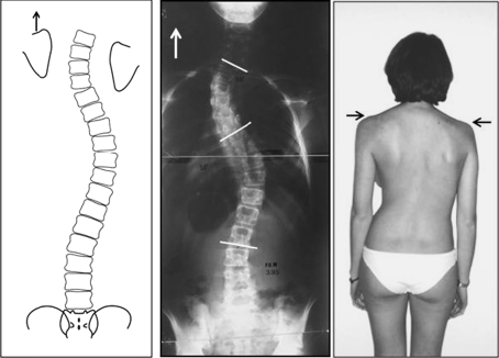 Fig. 3