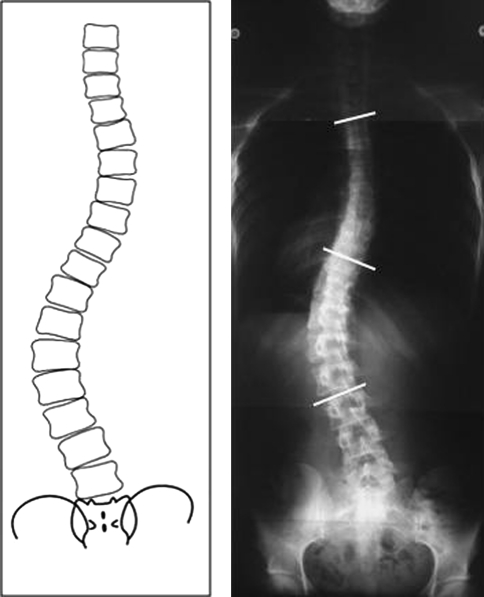 Fig. 6