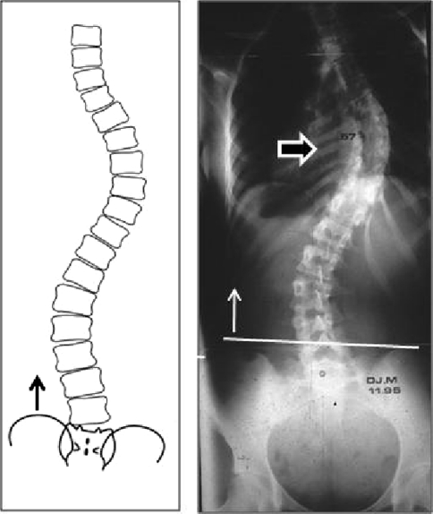 Fig. 2