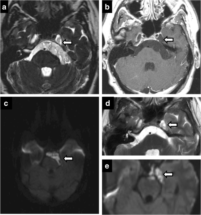 Fig. 18