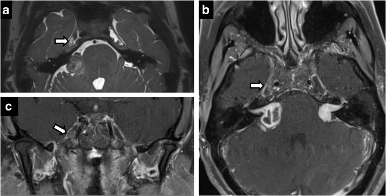 Fig. 9