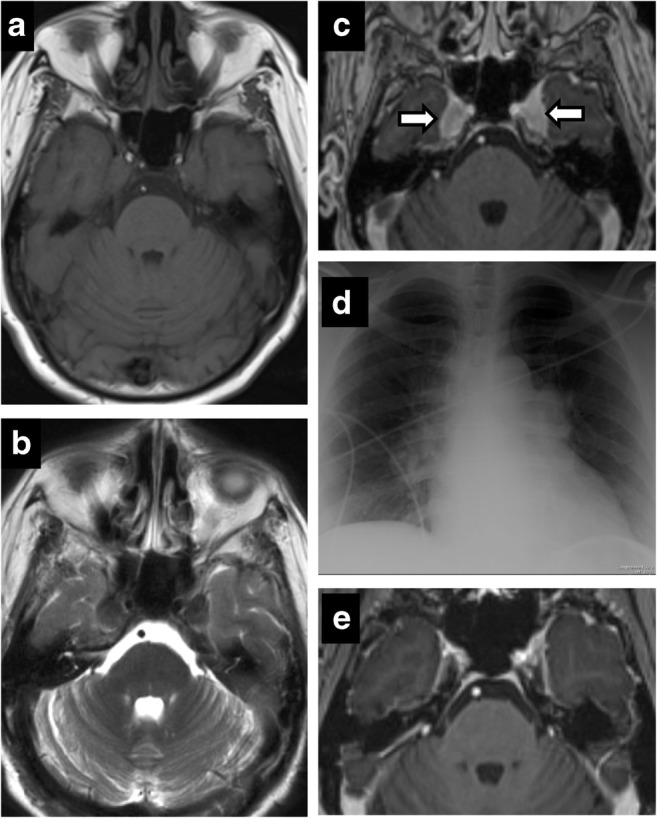 Fig. 12