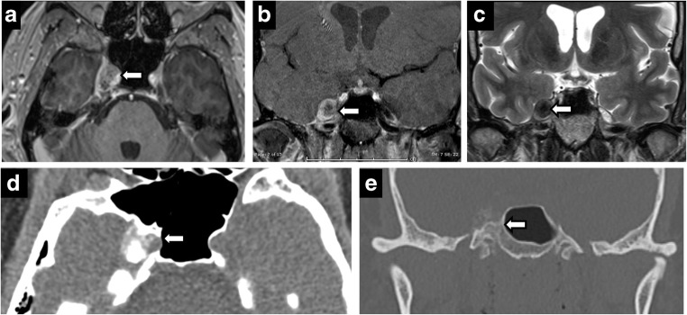 Fig. 15