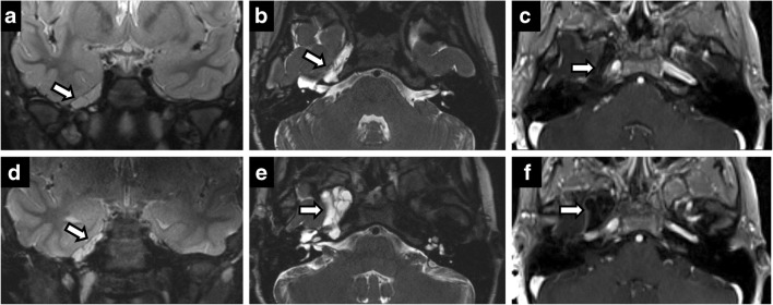 Fig. 17