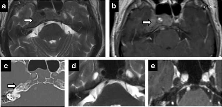 Fig. 11