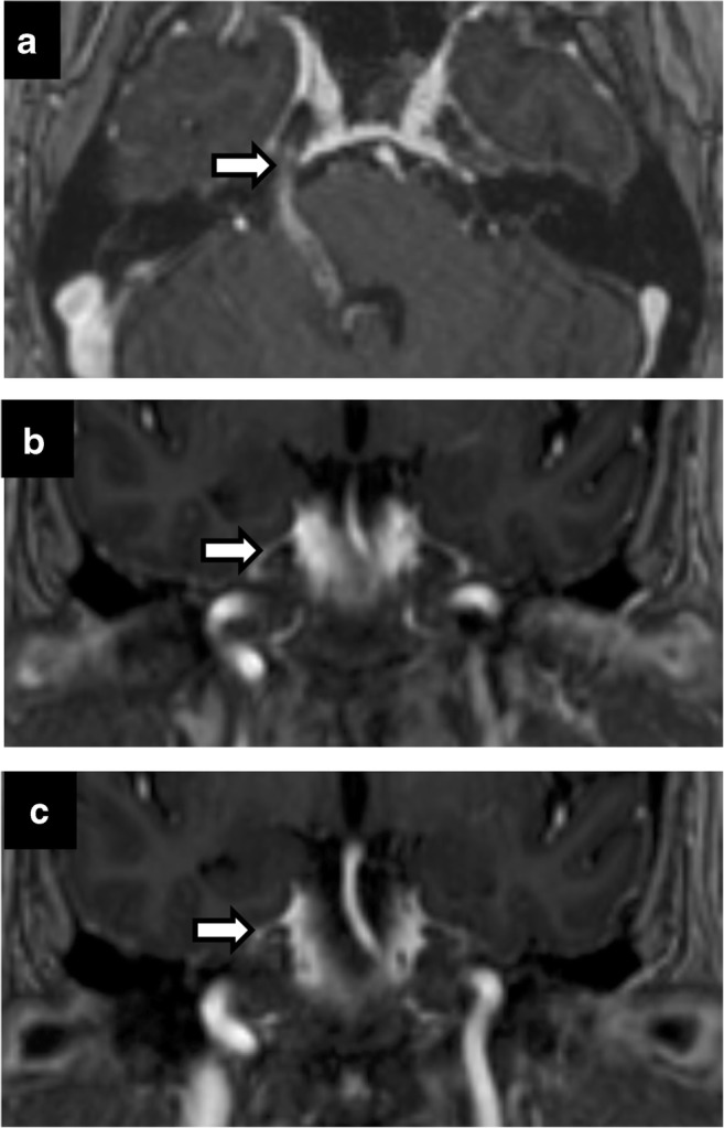 Fig. 5