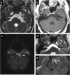 Fig. 18