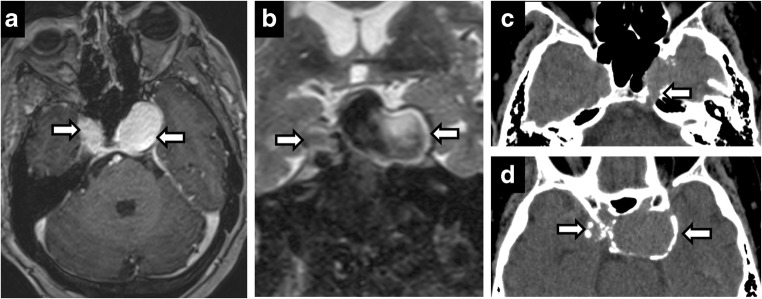 Fig. 20