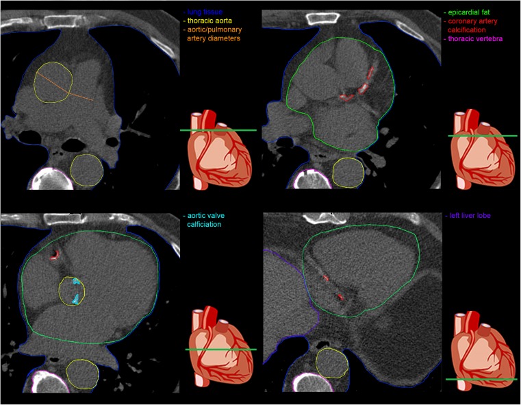 Fig. 1