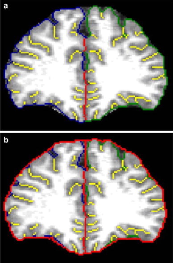 Fig. 1