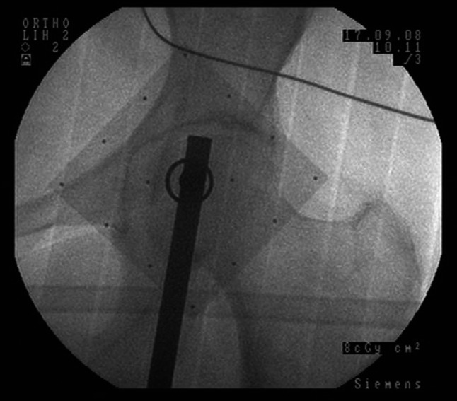 Fig. 3