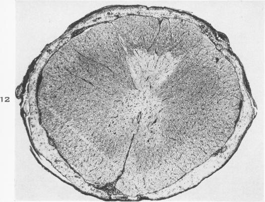 Fig. 12