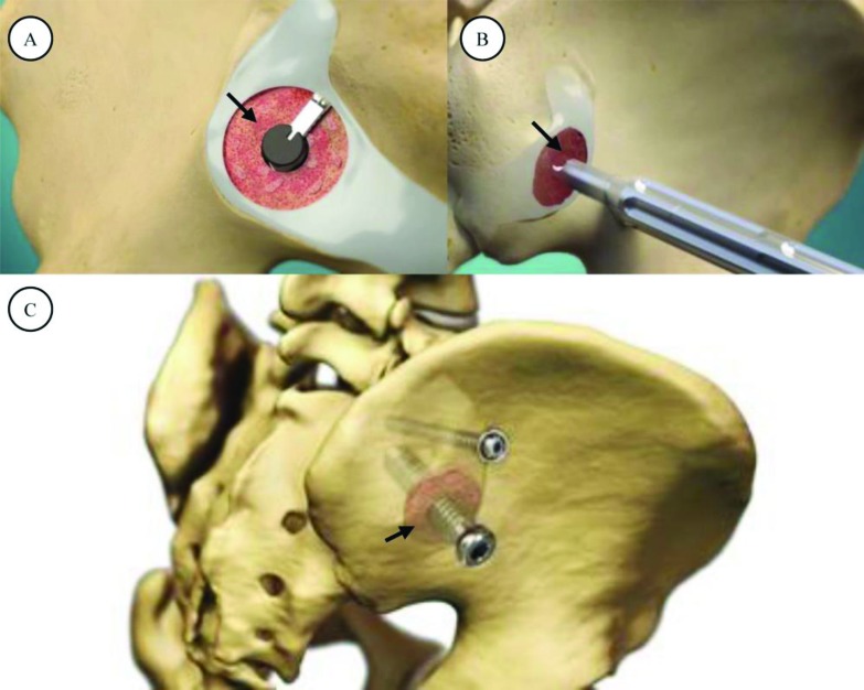 Fig. (1)