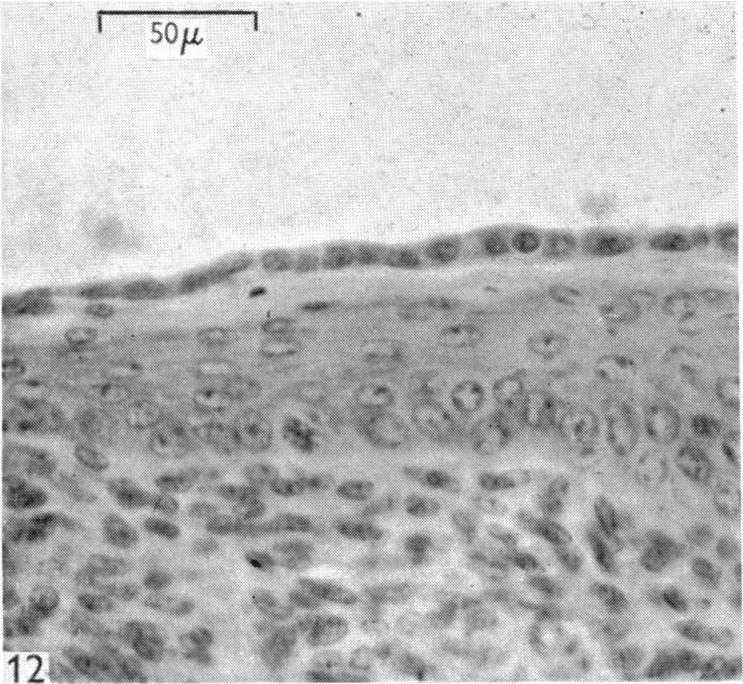 Fig. 12