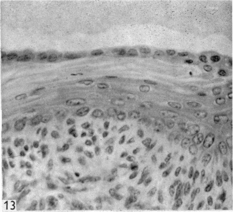 Fig. 13