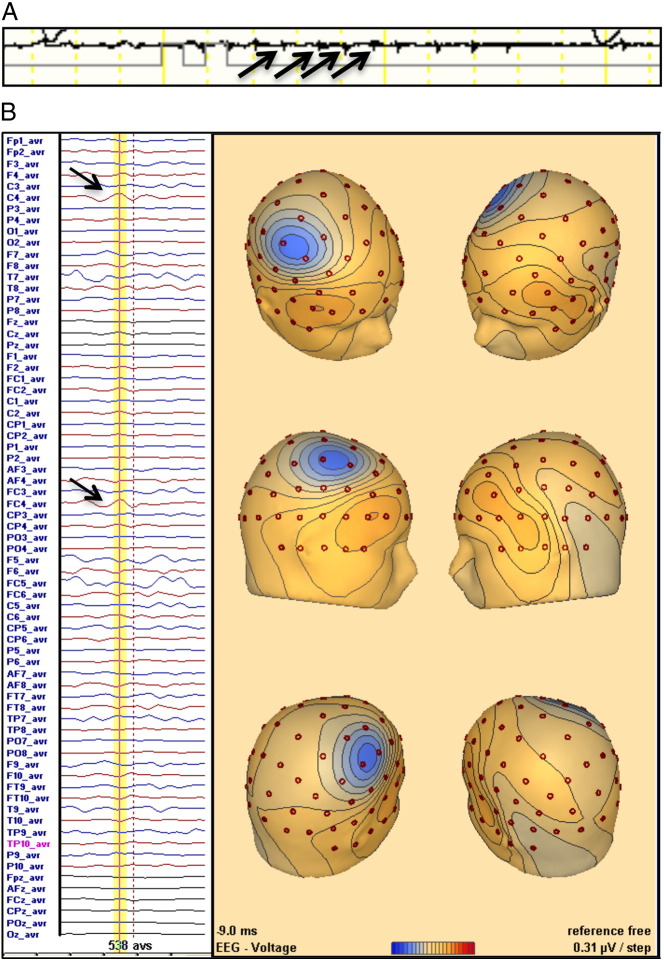 Fig. 1