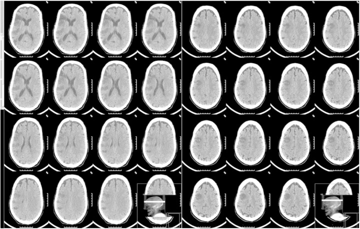 Fig. 2