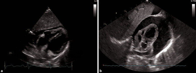 Fig. 14