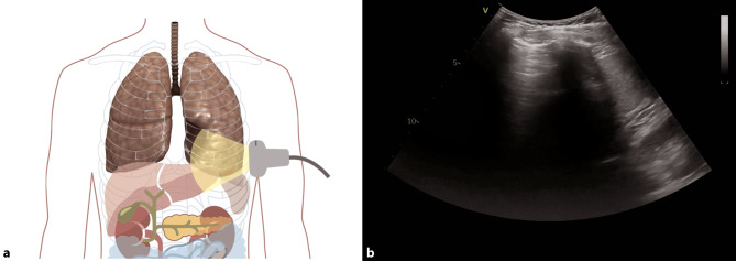 Fig. 10