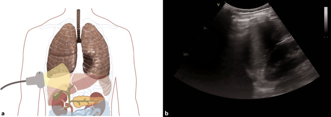 Fig. 9