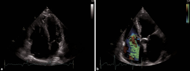 Fig. 15