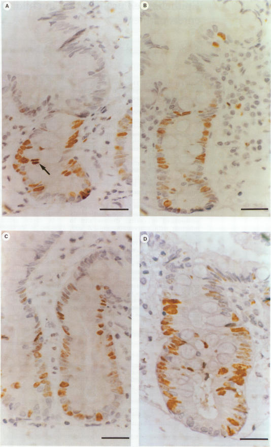 Figure 1: A-D