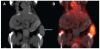 Figure 70