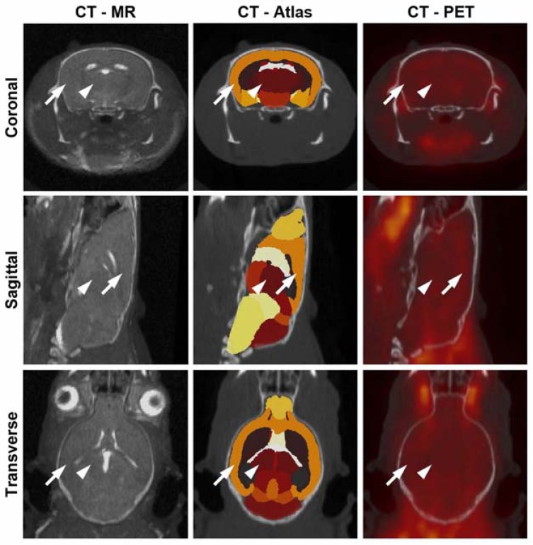 Fig. (1)