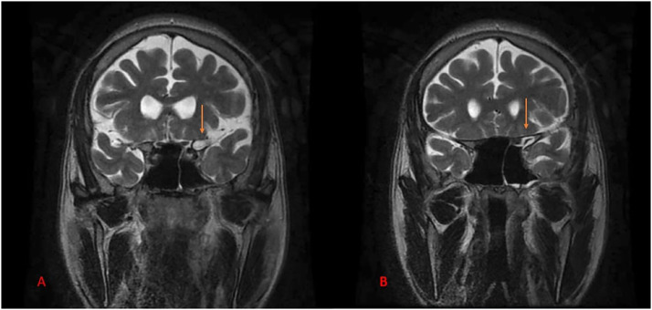 Fig 3: