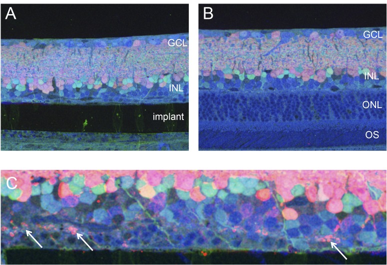 Figure 4