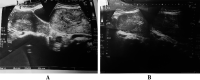 Fig.1