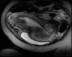 Fig.2