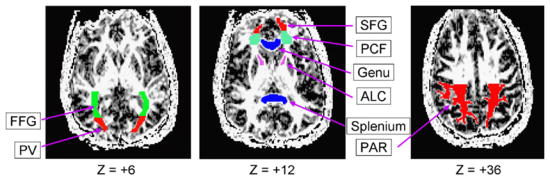 Fig. 4