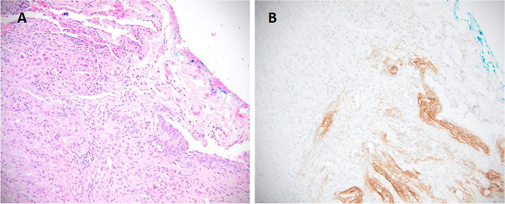 Fig. 3