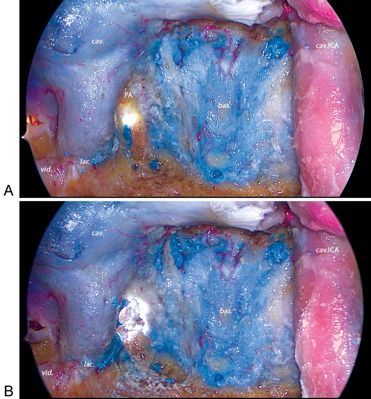 Fig. 9