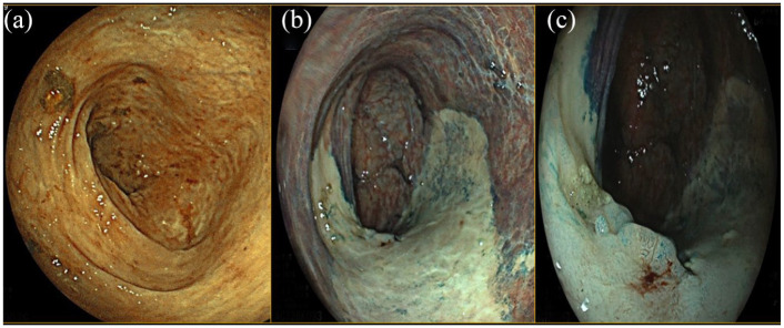 Figure 2.