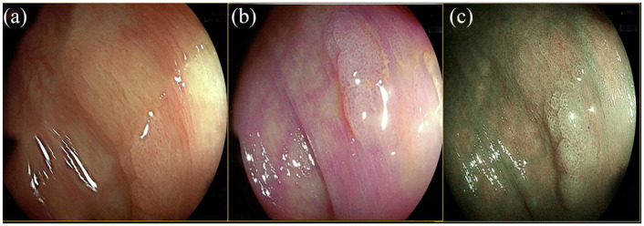 Figure 3.