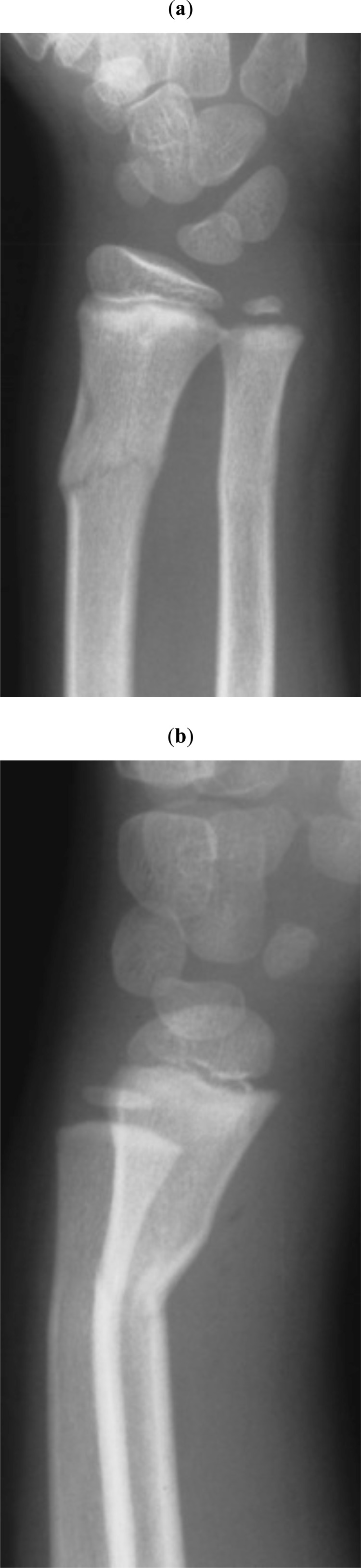 Fig. (2)