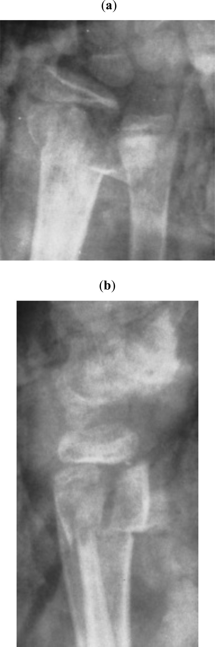 Fig. (4)