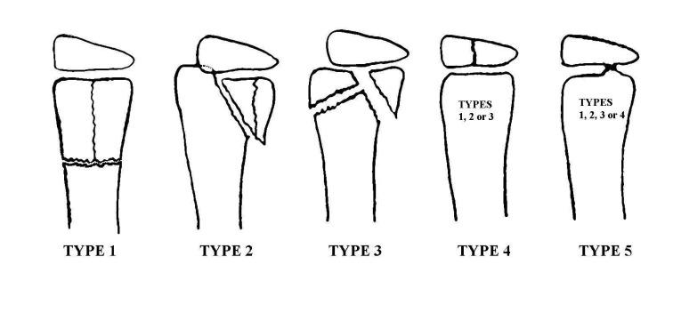 Fig. (1)