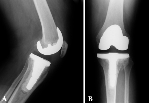 Fig. 5A–B