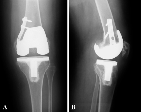 Fig. 4A–B