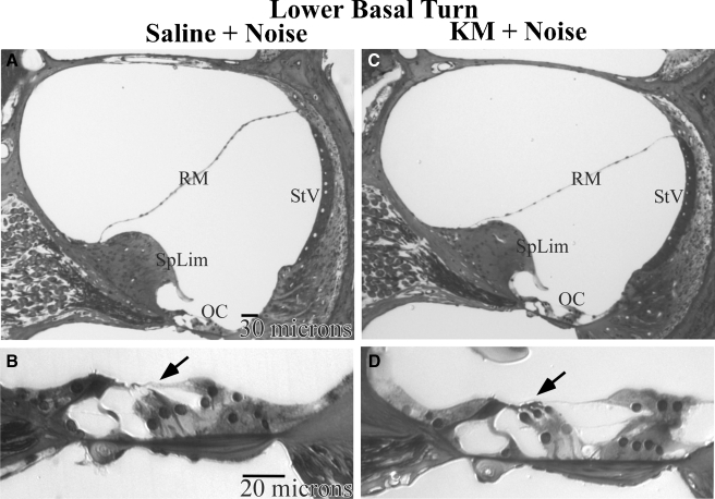 FIG. 6