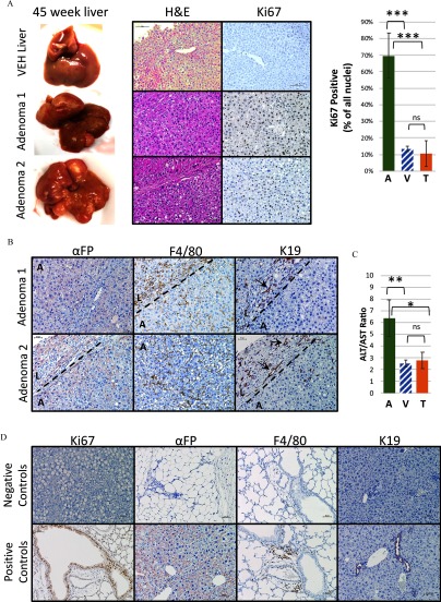 Figure 2A comprises representative images of VEH-exposed liver and tumors with hematoxylin and eosin and Ki67 immunohistochemistry staining in male mice, as well as a bar graph plotting Ki67 positive (percentage of all nuclei; y-axis) across treatment with adenoma, vehicle, and tumors (x-axis). Figure 2B shows representative tumors with alpha-feto protein, F4/80, and cytokeratin 19 (K19) immunostaining in male mice. Figure 2C is a bar graph plotting ratio of ALT to AST (y-axis) across treatment with adenoma, vehicle, and tumors (x-axis). Figure 2D shows representative tumors with Ki67, alpha-feto protein, F4/80, and K19 immunostaining in male mice.