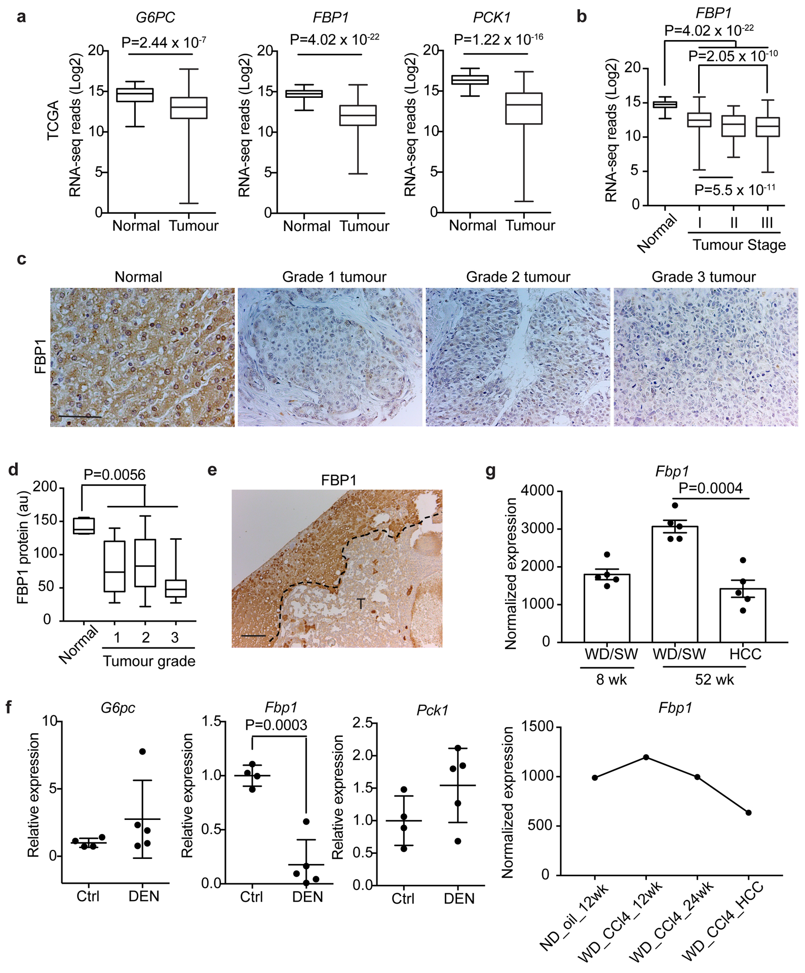 FBP1 loss disrupts liver metabolism and promotes tumourigenesis through ...